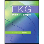 EKG Plain and Simple