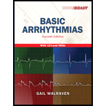 Basic Arrhythmias