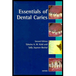 Essentials of Dental Caries