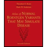 Atlas of Normal Roentgen Variants