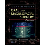 Contemporary Oral and Maxillofacial Surgery