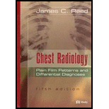 Chest Radiology