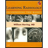 Learning Radiology