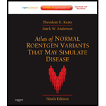 Atlas of Normal Roentgen Variants