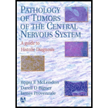 Histologic Diagnosis