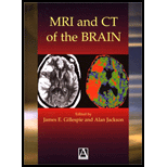 MRI and Ct of the Brain