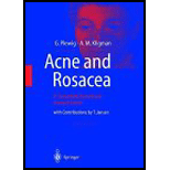 Acne and Rosacea