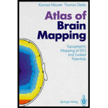 Atlas of Brain Mapping  Topographic Mapping of EEG & Evoked Potentials