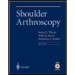 Shoulder Arthroscopy