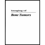 Imaging of Bone Tumors  A Multimodality Approach