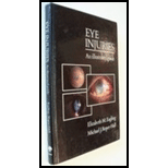 Eye Injuries Illustrated Guide