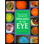 Atlases of Diseases of the Eye