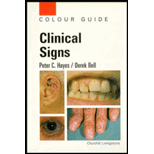 Clinical Signs