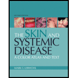 Atlas of the Skin and Systemic Disease