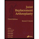 Reconst. Surgery of the Joints 2 Volumes