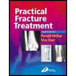 Practical Fracture Treatment