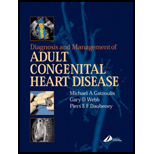 Diagnosis and Management Congenital Heart