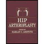 Hip Arthroplasty