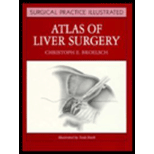 Atlas of Liver Surgery