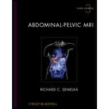 Abdominal Pelvic MRI