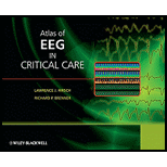 Atlas of EEG in Critical Care