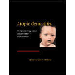 Atopic Dermatitis