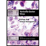 Varicella Zoster Virus