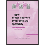 Upper Motor Neurone Syndrome and Spasticity