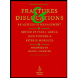 Fractures & Dislocations