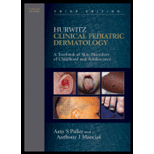 Hurwitz Clinical Pediatric Dermatology  Textbook of Skin Disorders of Childhood and Adolescence