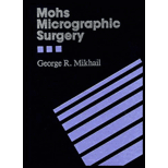 Mohs Micrographic Surgery