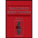 Imaging of Bone Tumors