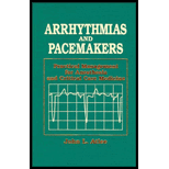 Arrhythmias and Pacemakers