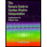 Nurses Guide to Cardiac Rhythm Interpretation Implications for Patient Care