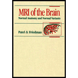 MRI of the Brain  Normal Anatomy and Normal Variants