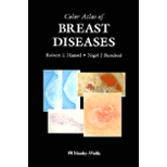 Color Atlas of Breast Diseases