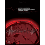 Neurophysiological Monitoring During Intensive Care and Surgery