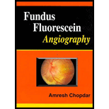 Fundus Fluorescein Angiography