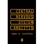 Central Nervous System Angiitis