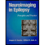 Neuroimaging in Epilepsy  Principles and Practice