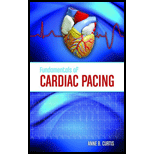 Fundamentals of Cardiac Pacing