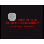 Atlas of Adult Electroencephalography