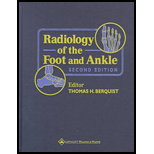 Radiology of Foot and Ankle