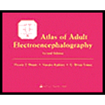 Atlas of Adult Electroencephalography