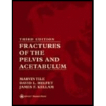 Fractures of Pelvis and Acetabulum 3RD Edition, Tile (9780781732130 