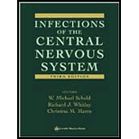 Infections of Central Nervous System