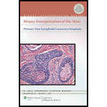 Biopsy Interpretation of the Skin Primary Non Lymphoid Neoplasms of the Skin