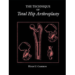 Technique of Total Hip Arthroplasty