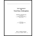 Technique of Total Knee Arthroplasty