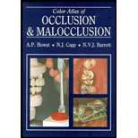 Colour Atlas of Occlusion and Malocclusion